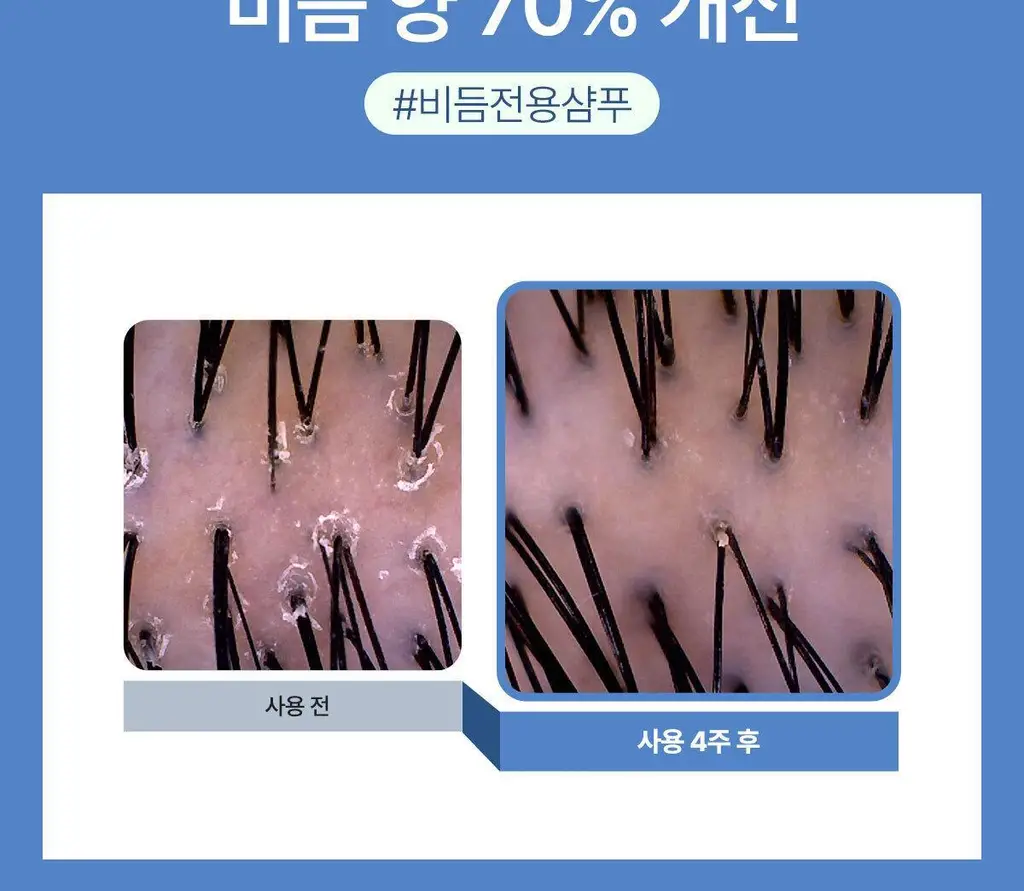 [New/현대약품특허]마이녹셀 댄드러프 스칼프 쿨링 샴푸 480ml 상세페이지 12